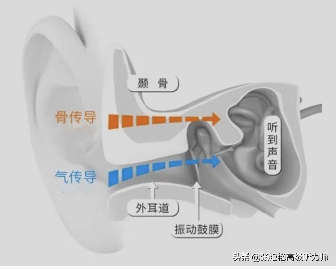 入耳式和耳塞式的区别（头戴、入耳、耳塞、骨传导耳机听力伤害盘点）(1)