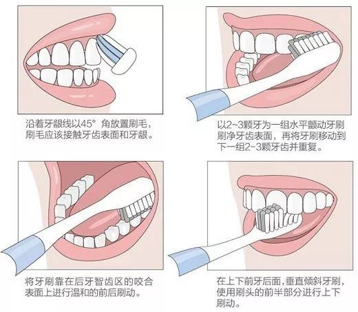 宝宝口臭是消化不良？医生：做到这一点，绝大部分口臭都会被消灭