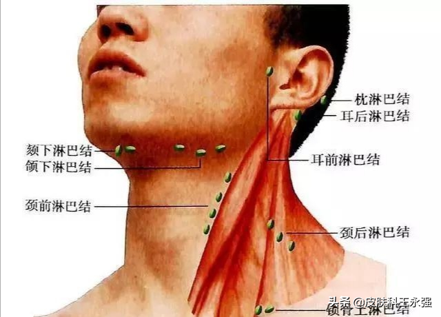 ⒈颈部淋巴结肿大一般都是由于炎症而引发的