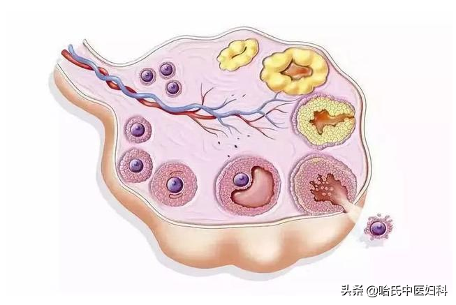 多囊卵巢综合征不孕3年，四次促排失败，拼了命也要生个儿子