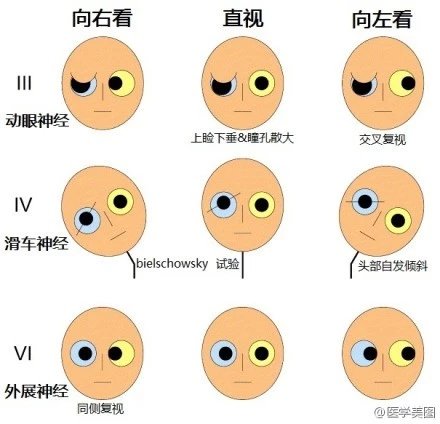 神经元结构示意图（神经元结构示意图手绘）-第42张图片-科灵网