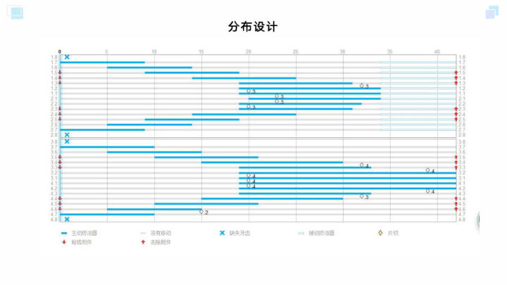 广州牙齿矫正杨露隐适美隐形矫正戴牙套全案例