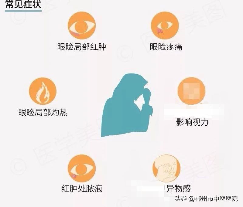 眼睛紅腫，可能是“针眼”上门找麻烦