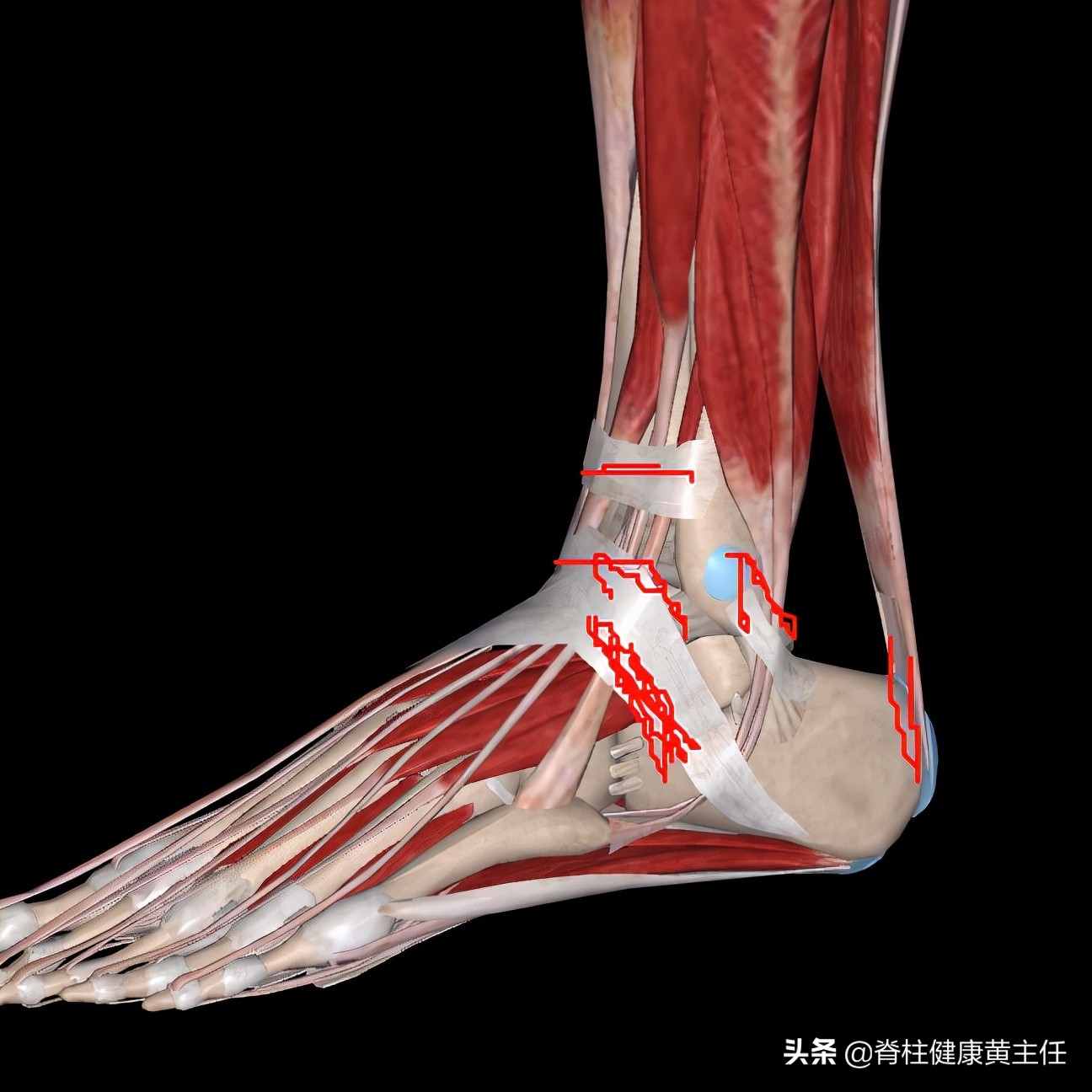 踝关节扭伤的正确处理方式