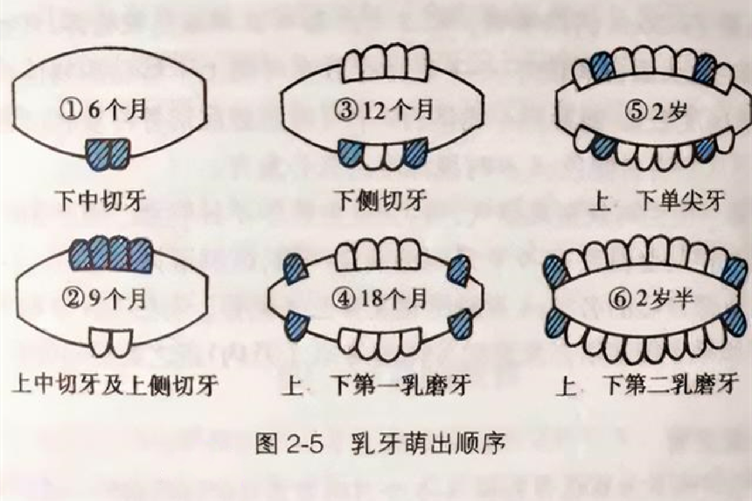 宝宝何时出牙算正常？几个信号要记牢，助娃缓解不适很关键