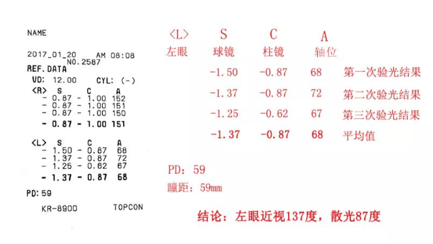 網(wǎng)上眼鏡選購指南，驗光，鏡片鏡架選擇總攻略