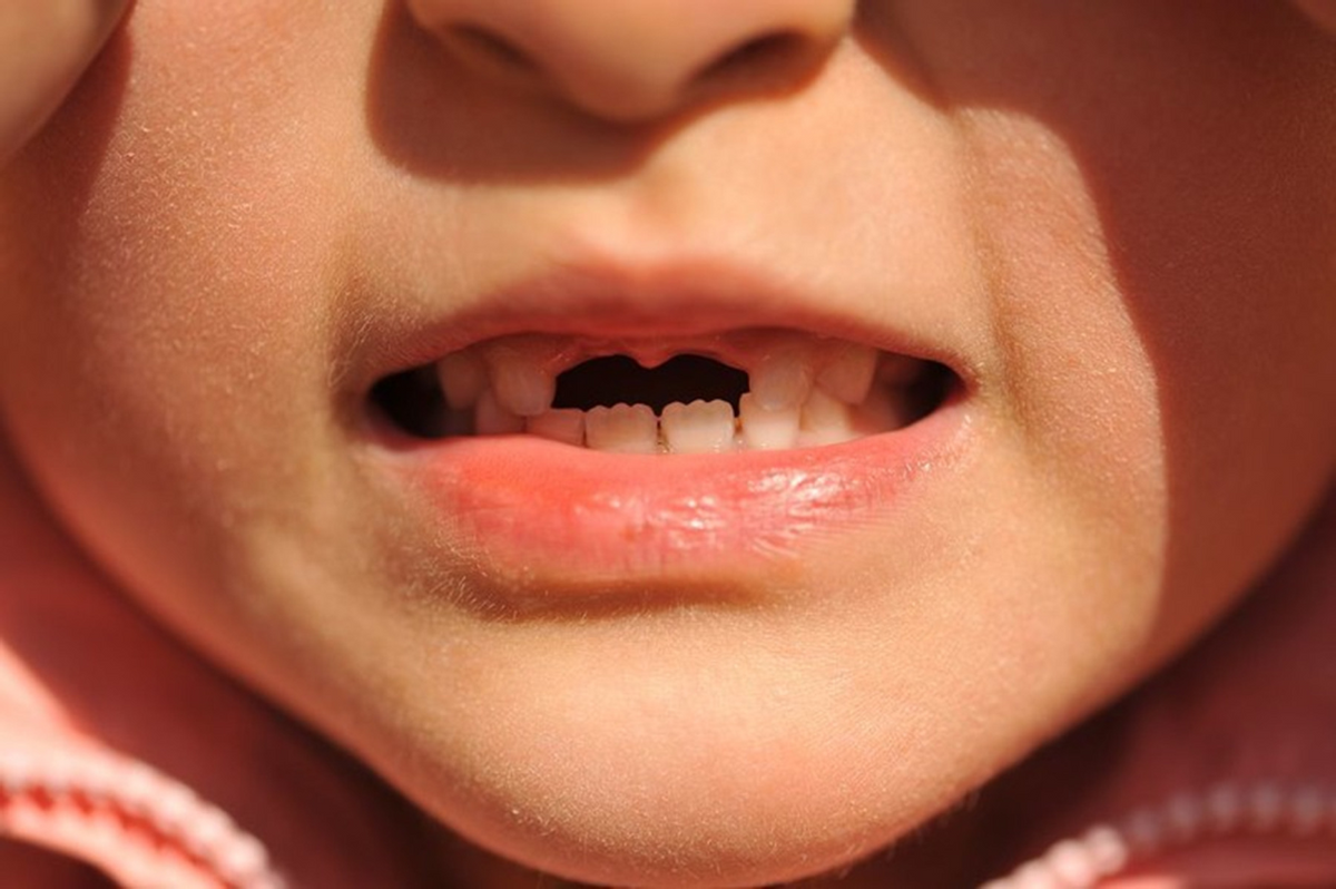 儿童换牙时间表，换牙如换脸，不让孩子颜值输在一颗牙上