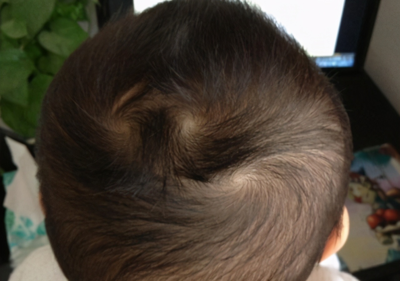 婴儿头发竖起来是什么原因(一旋横俩旋拧) - 乐宝宝贝