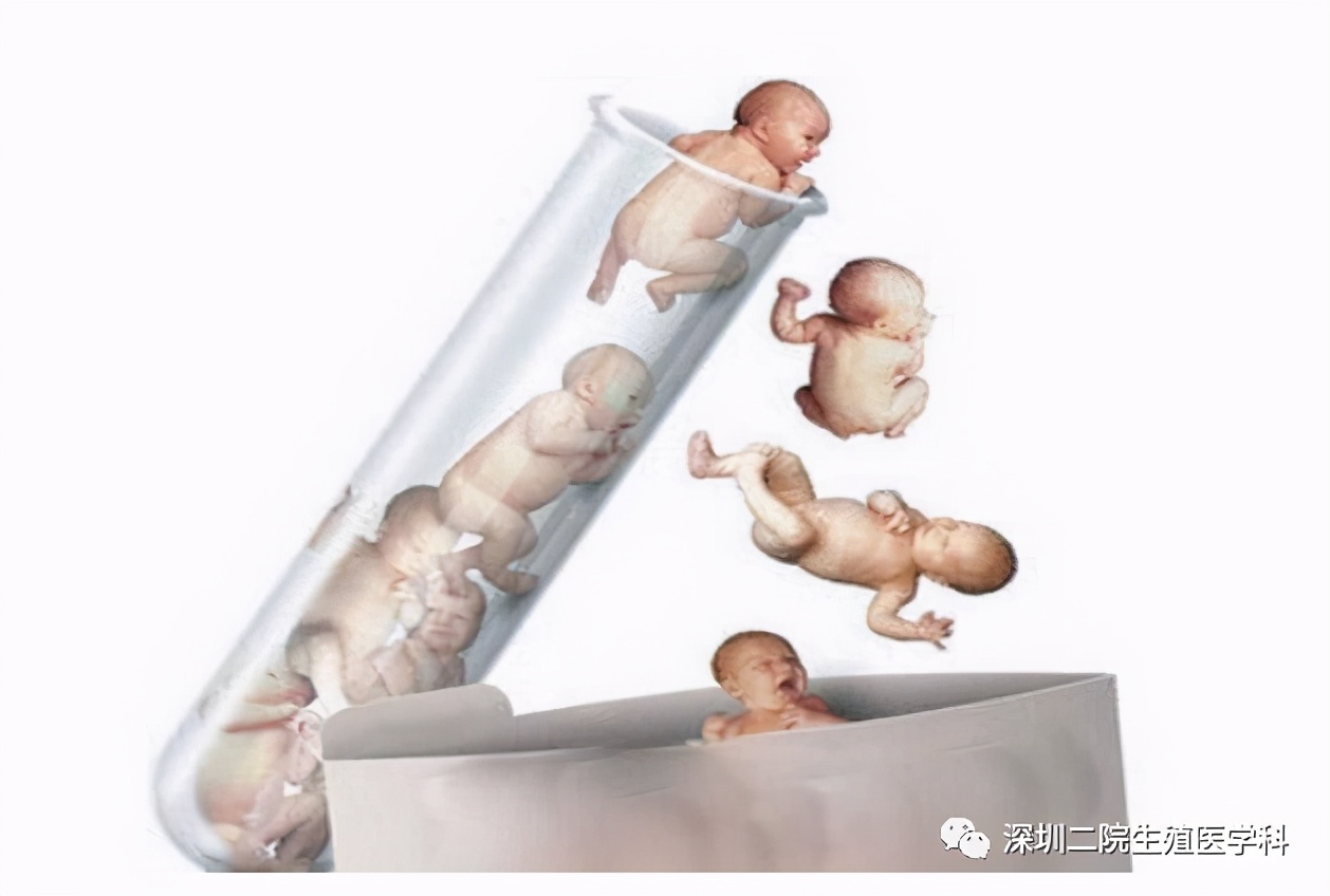 21染色体异常婴儿照片图片