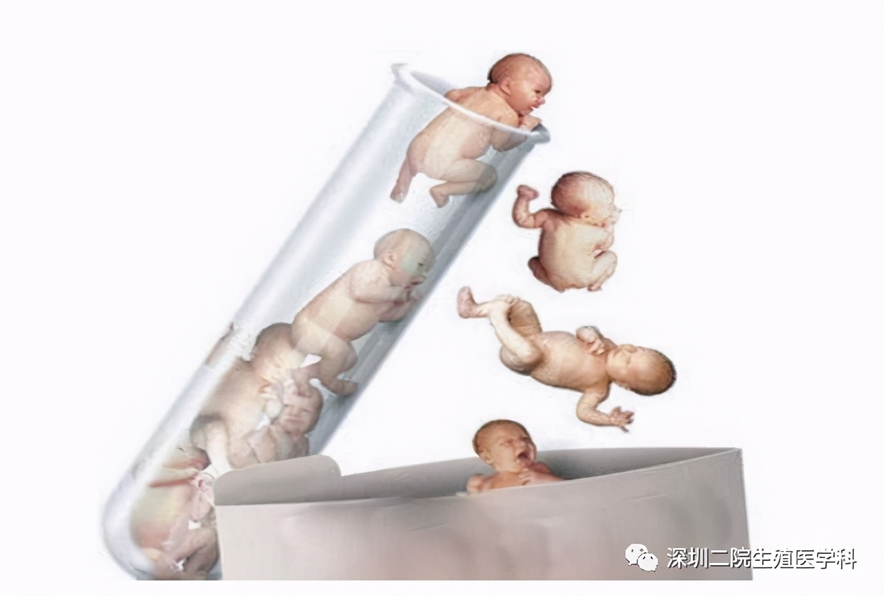1)年龄偏大的人群,染色体畸变率要高于年轻人群,染色体异常是流产重要