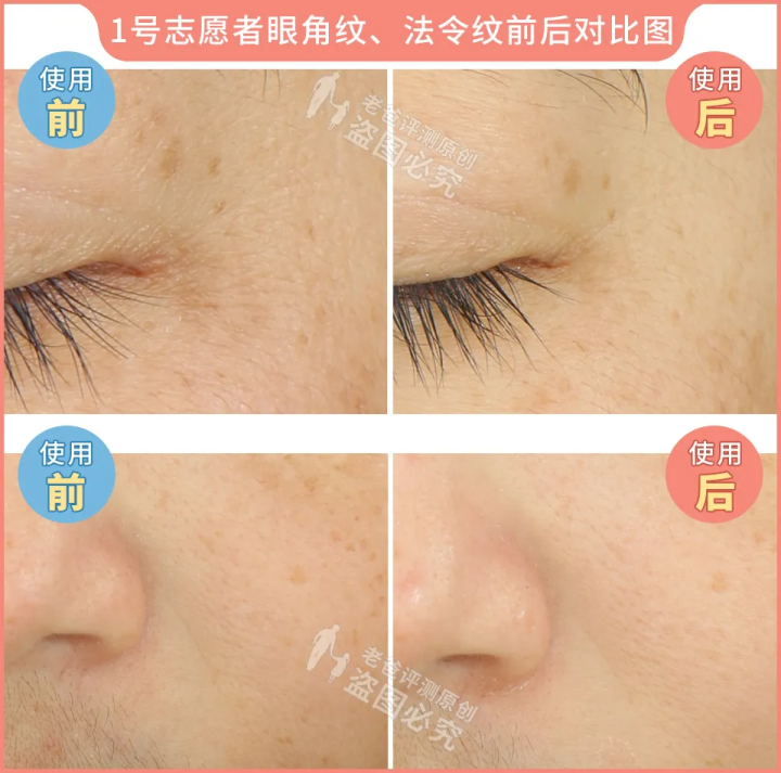 网红家用美容仪真的有效吗？2个多月的跟踪实测结果来了