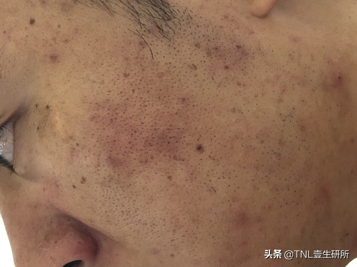 如何区分皂基洗面奶和氨基酸洗面奶？哪种更好用？