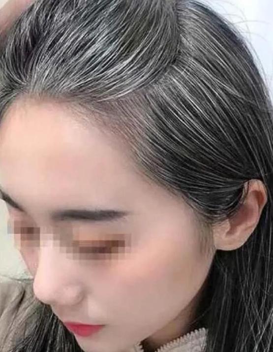 如果女性白头发增多，不要总认为老了，或是因为体内缺乏3种营养