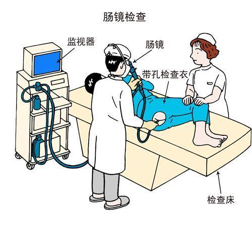 肠镜检查过程是怎样的？普通的和无痛的肠镜，应该怎么选择？