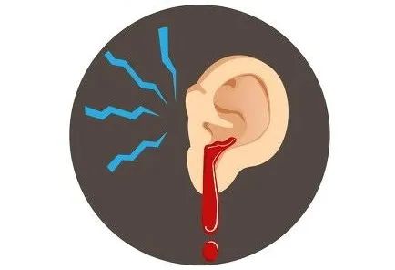 耳朵出血"堵"上很危险,那鼻子,眼睛出血又该怎么办?