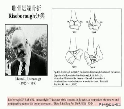 肱骨远端骨折的分型和治疗原则