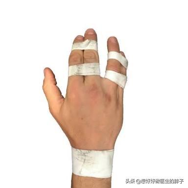 排球手指受伤怎么处理(手指打篮球挫伤了，半年不恢复，还肿着，听听医生给您的治疗建议)