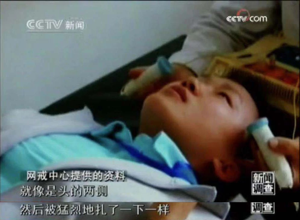 杨永信，谁给了你电击孩子的权利？最该被电醒的是那些孩子的父母