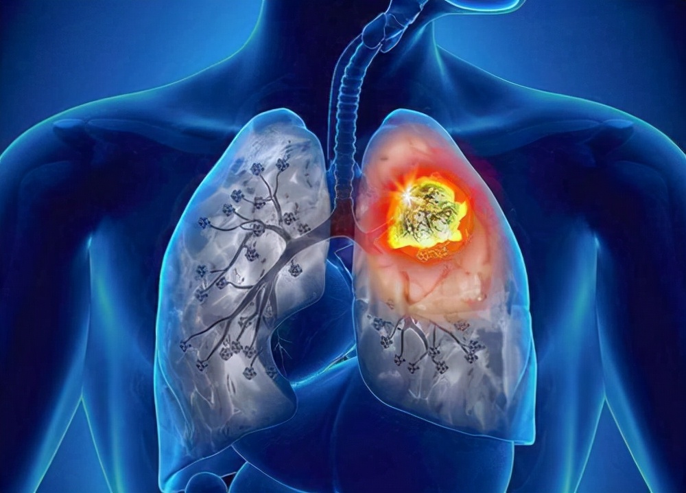 右胸口上方隐隐作痛是怎么回事女性「两胸下面中间位置疼」-友友