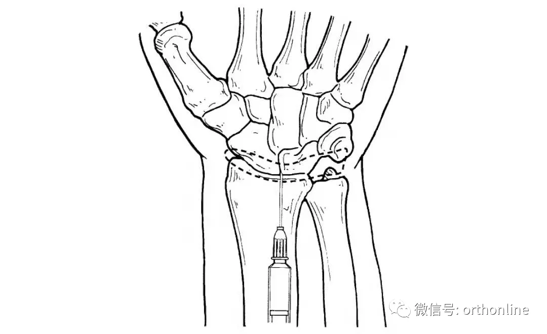 活检怎么做（临床实用）