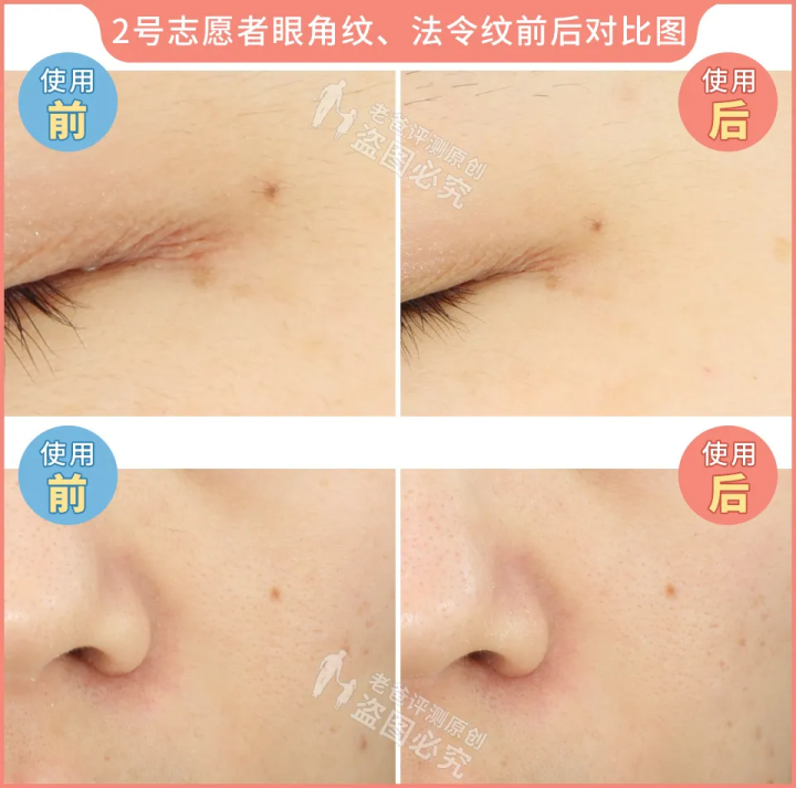 网红家用美容仪真的有效吗？2个多月的跟踪实测结果来了