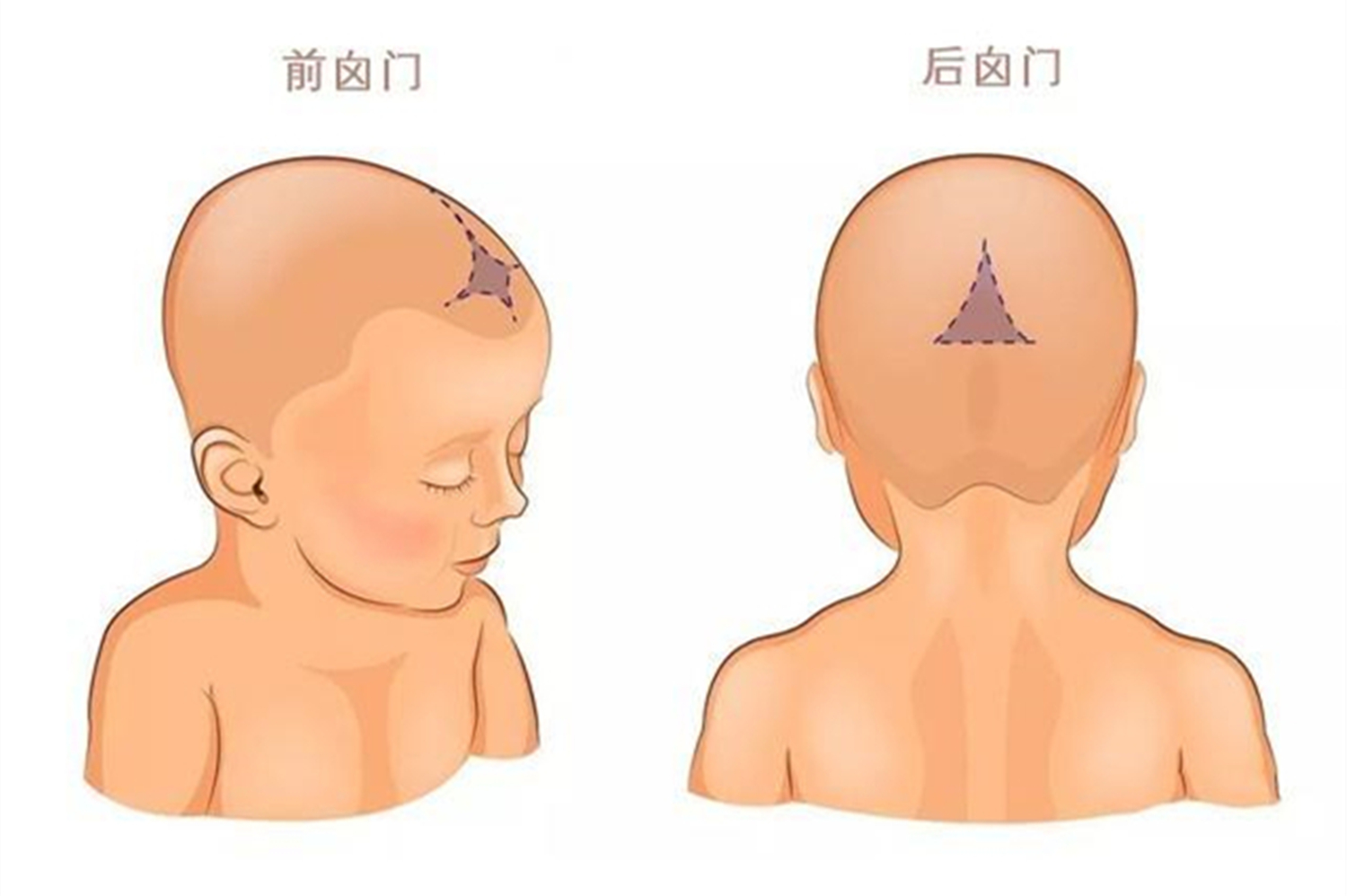 宝宝囟门闭合太早，对大脑发育有影响，有这三种情况要重视
