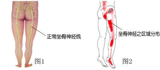 腰椎疾病、腰椎间盘突出你想知道的事全集！