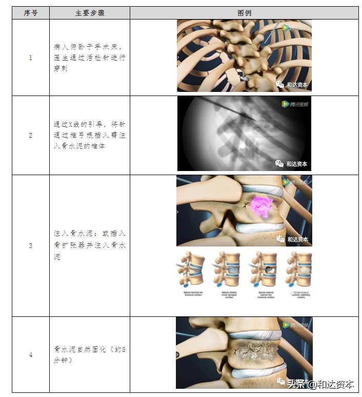 微创骨科医疗器械初步分析