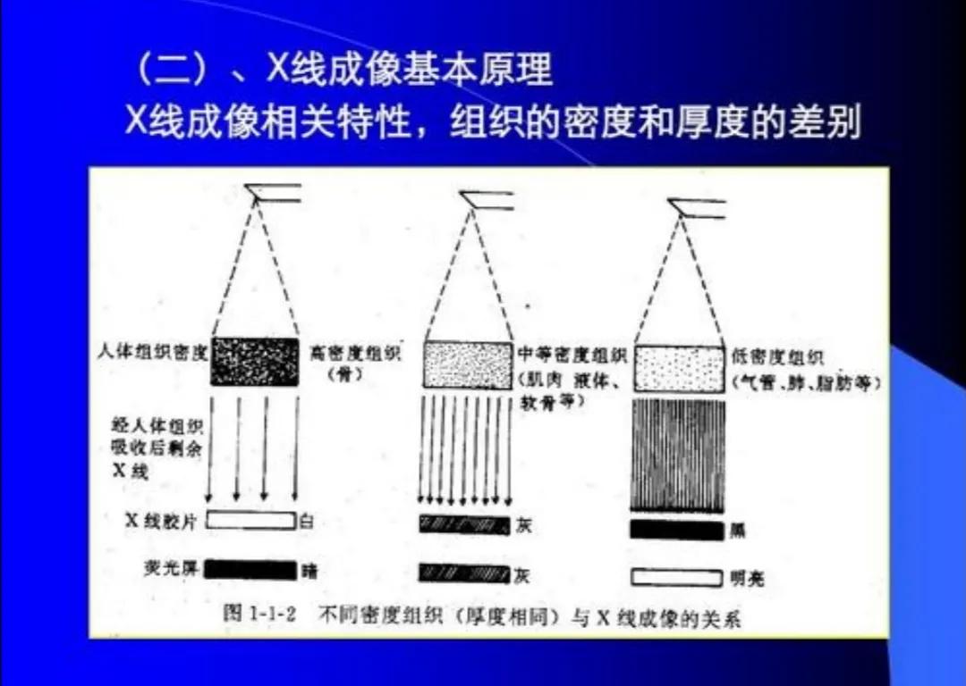 腰腿疼，磁共振比CT照得最清楚？医生辟谣，有钱选不对，也白搭