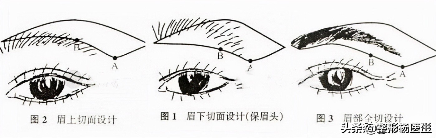 切眉、提眉有什么区别？你更适合哪种方法？