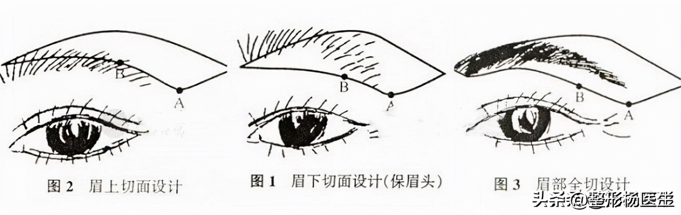 切眉、提眉有什么区别？你更适合哪种方法？