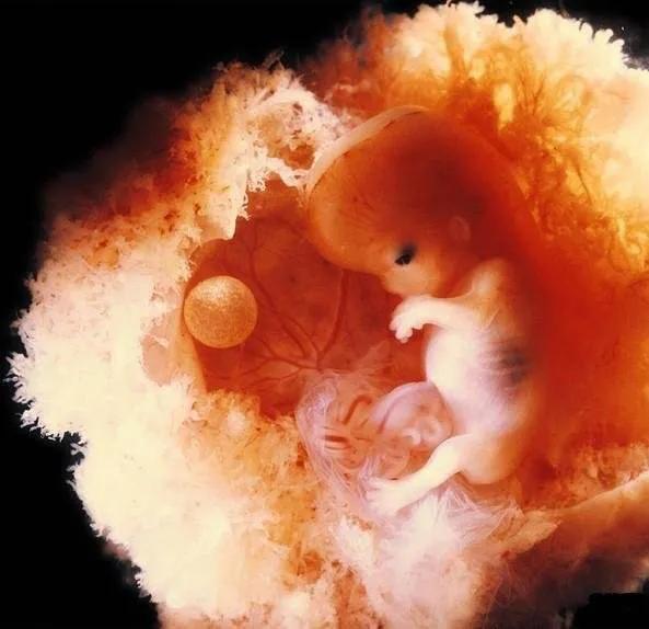孕早期胚胎图片