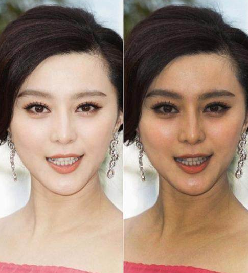 大s美白针怎么样 大s美白针真的有效吗-世界十大之最