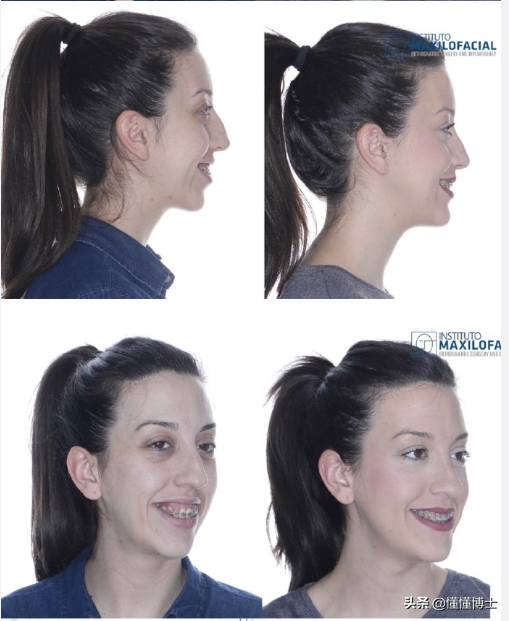 同样是凸嘴，为什么这些女明星就这么漂亮？两招教你摆脱土气脸