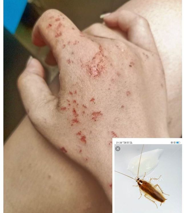 蟑螂卵长什么样图片(生命力很强的昆虫蟑螂)