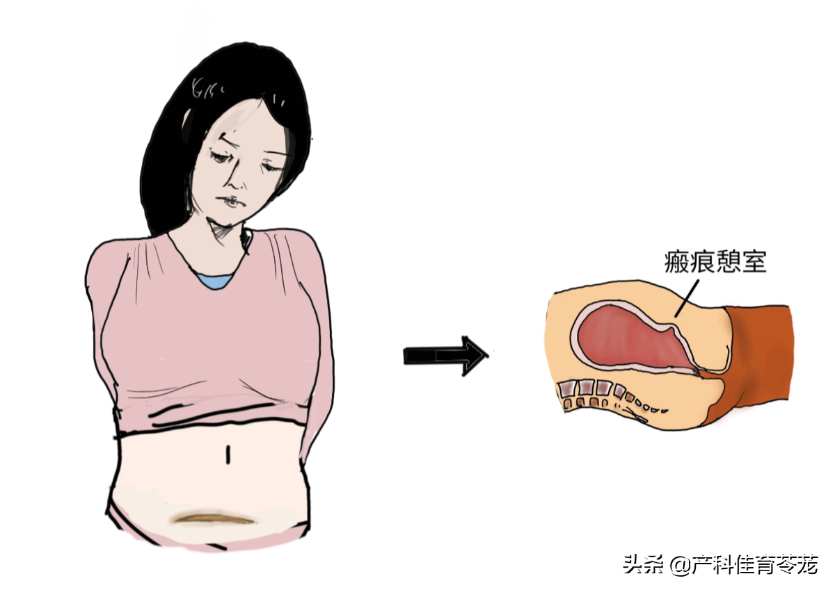 月经老不干净，年龄不同，病因不同