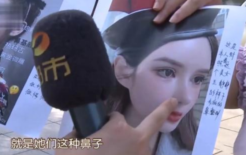 女子花40000元整鼻子，不料整成“怪物”？院方：手术很成功