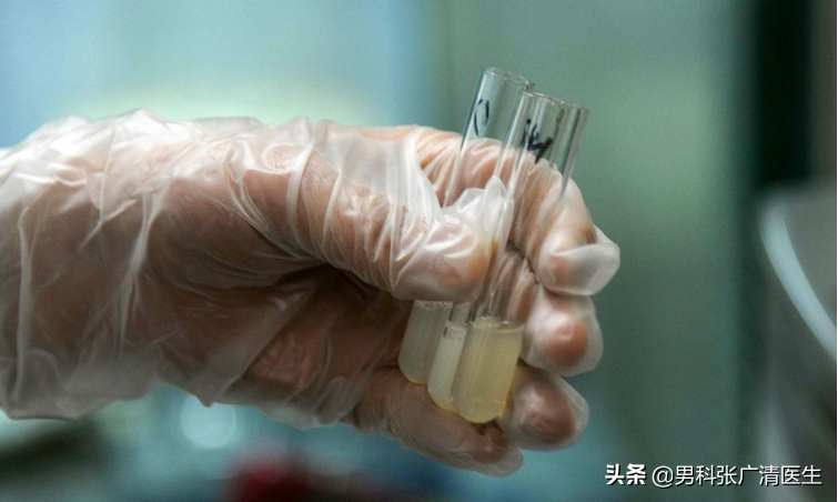 男性尿液出现白色浑浊物的常见原因及健康警示