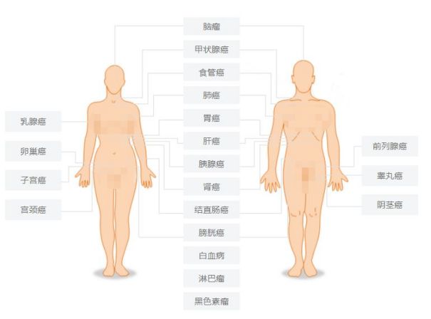 95%的体检都查不出癌症：癌症早筛是真有用，还是智商税？