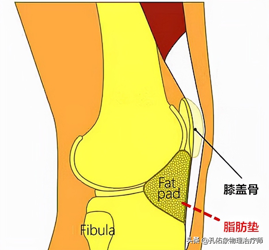 墊,是膝關節內滑膜外的一團特殊脂肪組織;填充在膝蓋骨和大腿骨下方