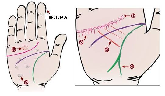 24种手诊图，堪比X光线，揭示你的身心健康