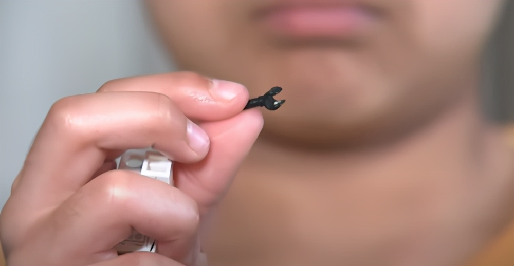 鼻窦炎抽出的脓图片(国外女子鼻子痛了37年) - 赤虎壹号