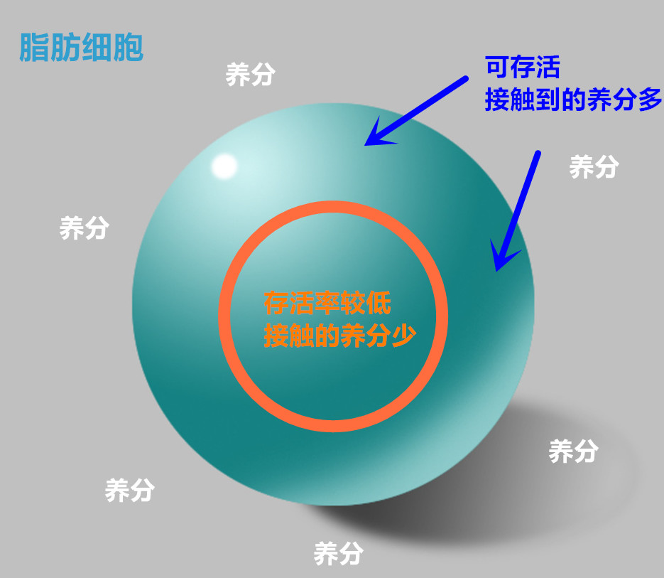 自体脂肪隆胸失败跟哪些原因有关系 自体脂肪丰胸有什么危害和后遗症吗