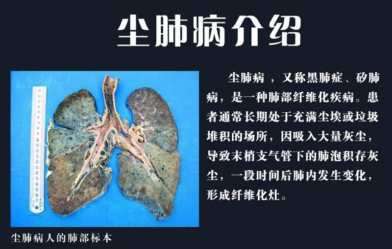 电焊工会有什么职业病，为什么月薪上万没人干？电焊危害有多大？