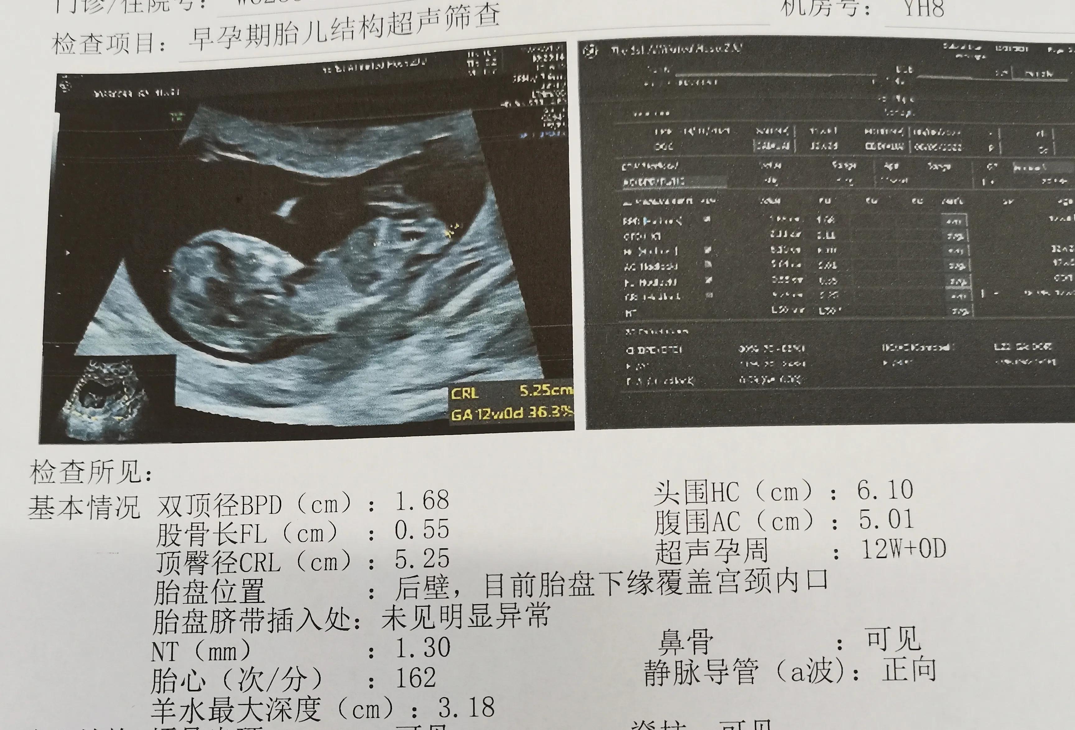 什么是试管婴儿视频（试管婴儿是什么）-幼儿百科-魔术铺