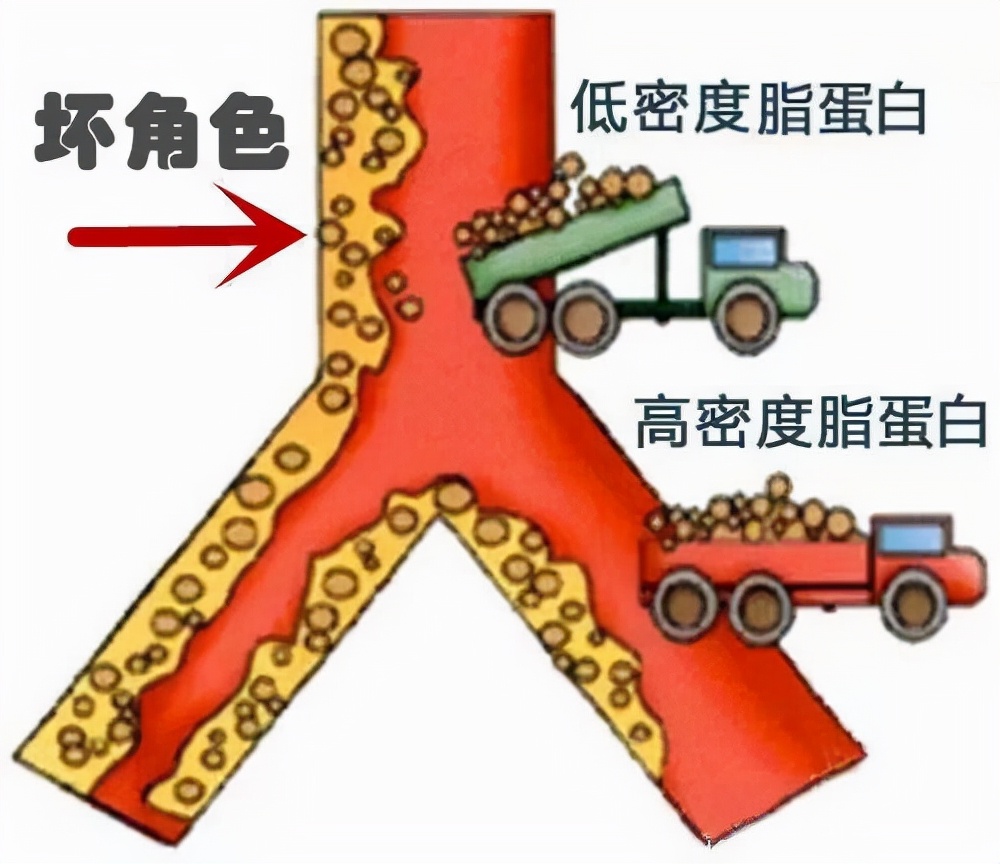 胆固醇升高，不要怕，哈佛大学：常吃这5种食物，胆固醇悄悄降