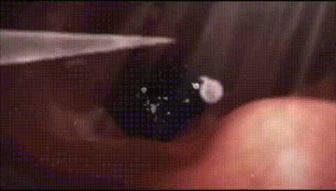 科学家拍到：人类卵子接受精子那一刻，真的会爆发出一阵巨大闪光