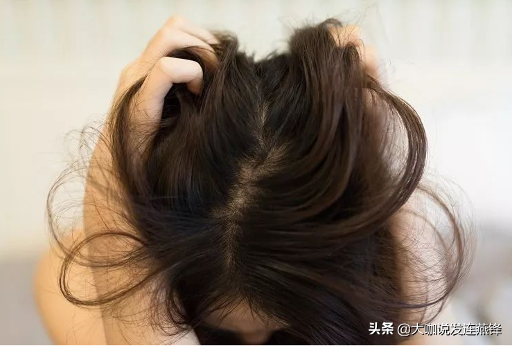 30岁女性，产后变秃，这个方法可以拯救