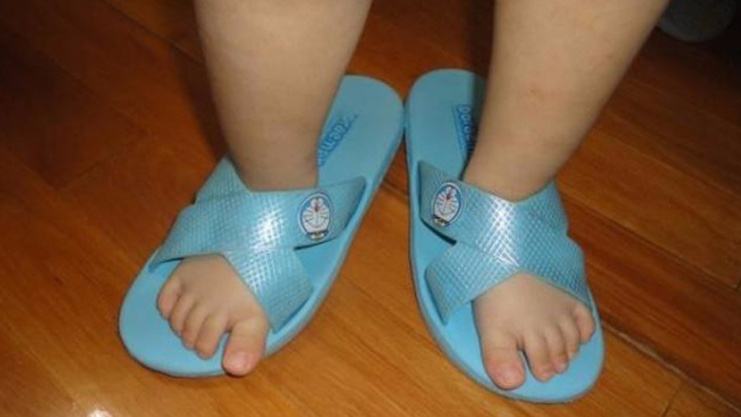 婴儿足弓反张图片(孩子爱穿反鞋还屡教不改) - 乐宝宝贝