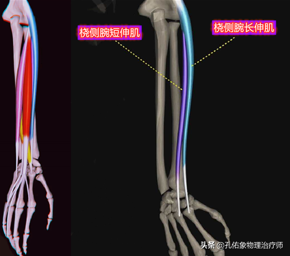 打羽毛球打到肘部痛什么原因(网球肘是累出来的，跟打网球没啥关系，如何预防及治疗？真相来了)